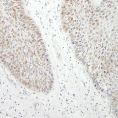 Rabbit anti-DDX21 IHC Antibody, Affinity Purified