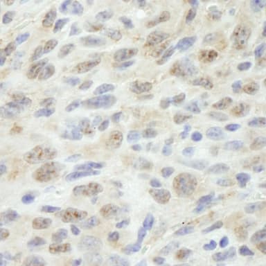 Rabbit anti-MED18 IHC Antibody, Affinity Purified