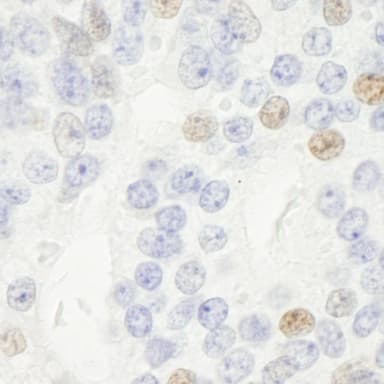 Rabbit anti-p14ARF IHC Antibody, Affinity Purified
