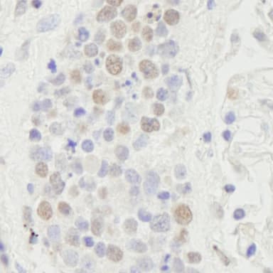 Rabbit anti-SUPT6H IHC Antibody, Affinity Purified