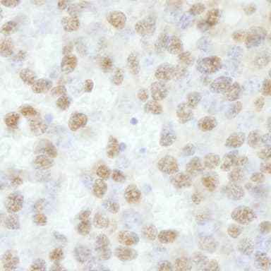 Rabbit anti-RBM16 IHC Antibody, affinity purified