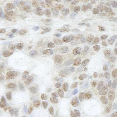 Rabbit anti-ATRX IHC Antibody, Affinity Purified