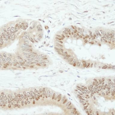 Rabbit anti-SSH3 IHC Antibody, affinity purified