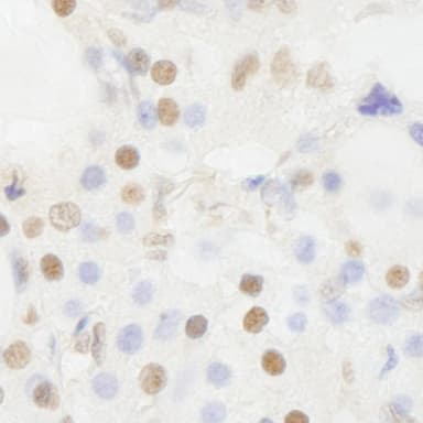 Rabbit anti-BRF1 IHC Antibody, Affinity Purified