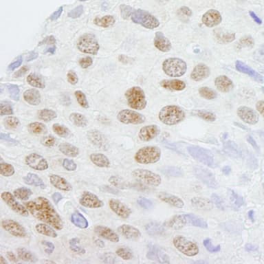 Rabbit anti-ZCCHC8 IHC Antibody, Affinity Purified