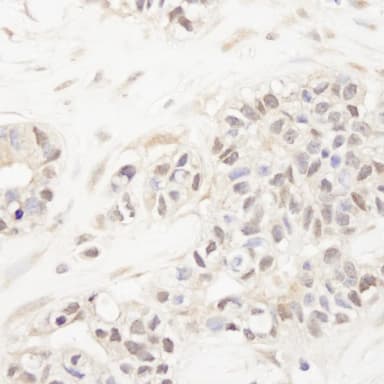 Rabbit anti-FOG1/ZFPM1 IHC Antibody, Affinity Purified