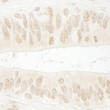 Rabbit anti-SSB1 IHC Antibody, Affinity Purified