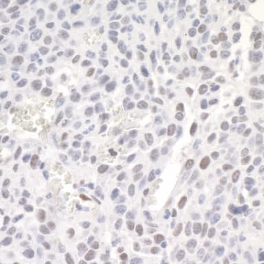 Rabbit anti-ZEB1 IHC Antibody, Affinity Purified