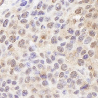 Rabbit anti-Ubiquitin IHC Antibody, Affinity Purified