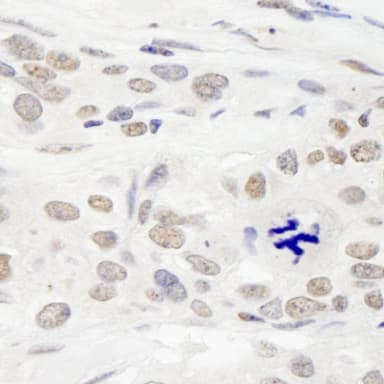 Rabbit anti-RAP1 IHC Antibody, Affinity Purified
