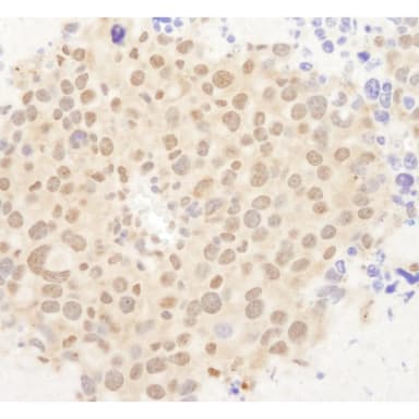 Rabbit anti-FOXO3a IHC Antibody, Affinity Purified