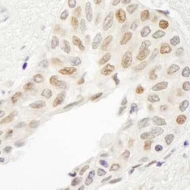 Rabbit anti-ATRIP IHC Antibody, Affinity Purified