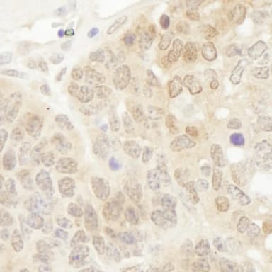 Rabbit anti-DJ-1 IHC Antibody, Affinity Purified