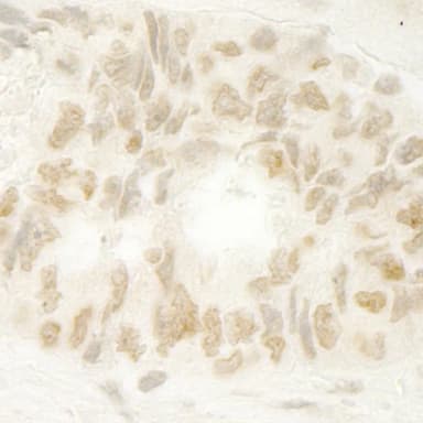 Rabbit anti-MKRN1 IHC Antibody, Affinity Purified