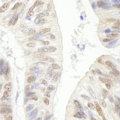 Rabbit anti-ERCC5/XPG IHC Antibody, Affinity Purified