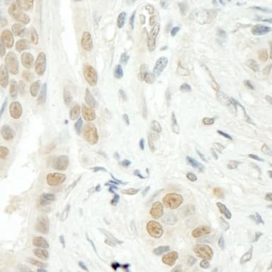 Rabbit anti-THOC5 IHC Antibody, Affinity Purified