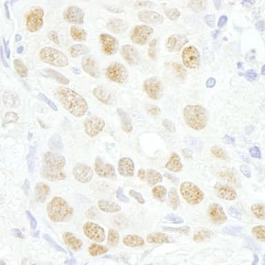 Rabbit anti-MAZ/SAF-1 IHC Antibody, Affinity Purified