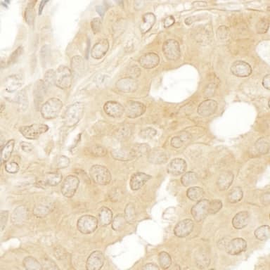 Rabbit anti-MEK2 IHC Antibody, Affinity Purified