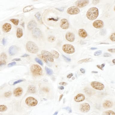 Rabbit anti-TOPORS IHC Antibody, Affinity Purified