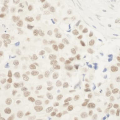 Rabbit anti-ZNF768 IHC Antibody, Affinity Purified