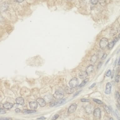 Rabbit anti-BAD IHC Antibody, Affinity Purified