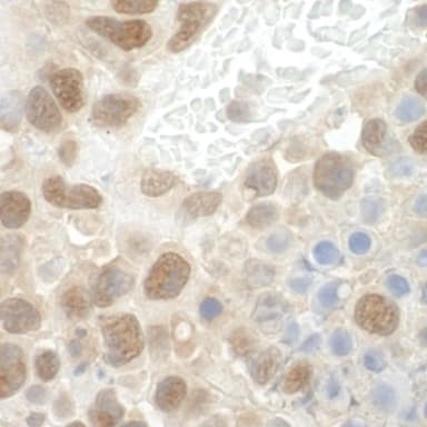 Rabbit anti-POGZ IHC Antibody, Affinity Purified